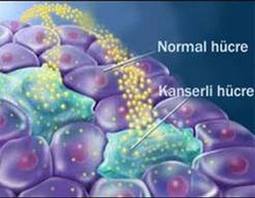 Kanser Hücrelerine 'Öldürücü' Etki